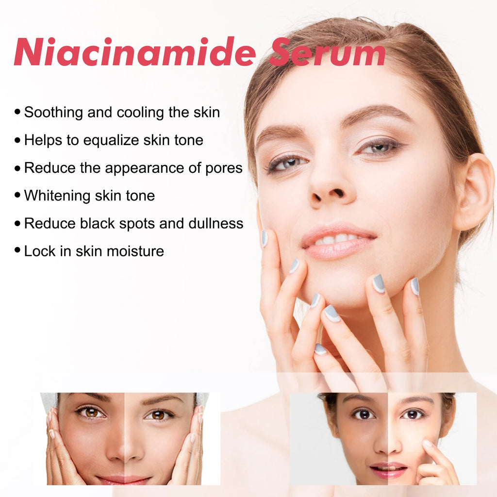 Sérum niacinamide 30ml éclaircissant les pores minimiseurs estompant les taches sombres hydratant uniformément le teint anti-âge du visage sérum non irritant
