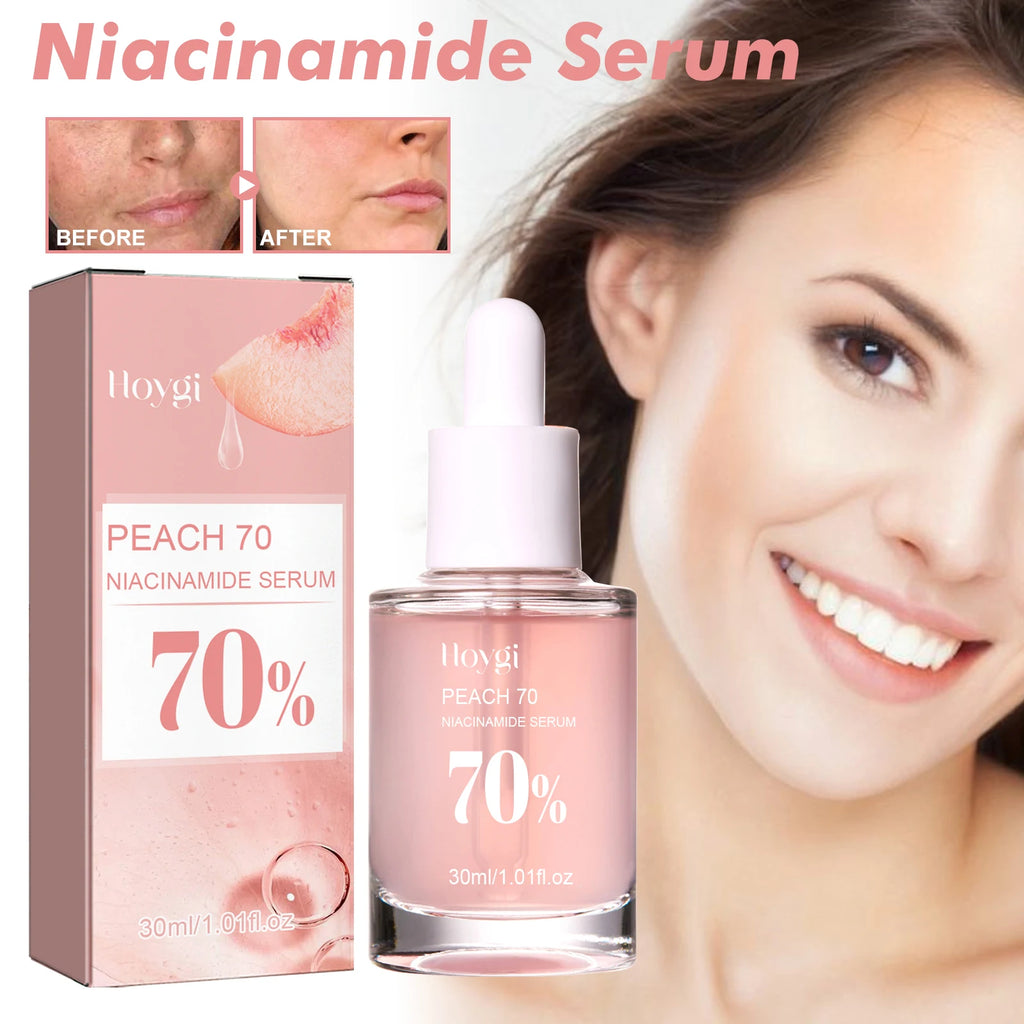 Sérum niacinamide 30ml éclaircissant les pores minimiseurs estompant les taches sombres hydratant uniformément le teint anti-âge du visage sérum non irritant