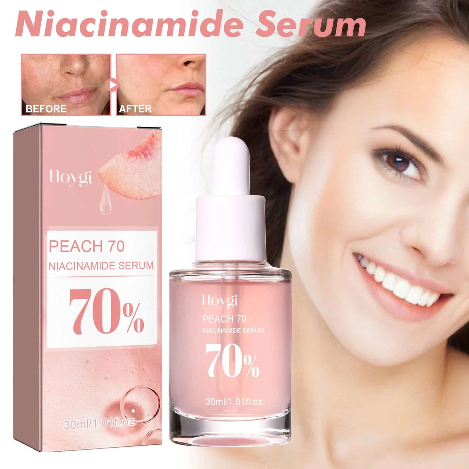 Sérum niacinamide 30ml éclaircissant les pores minimiseurs estompant les taches sombres hydratant uniformément le teint anti-âge du visage sérum non irritant