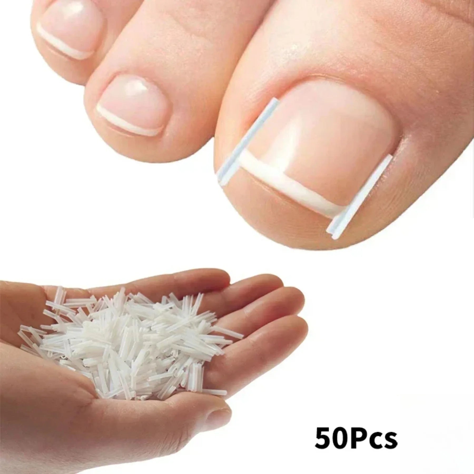 Kit de correction des ongles incarnés (50 pièces) : patch élastique, autocollant, clip redresseur et outil de pédicure