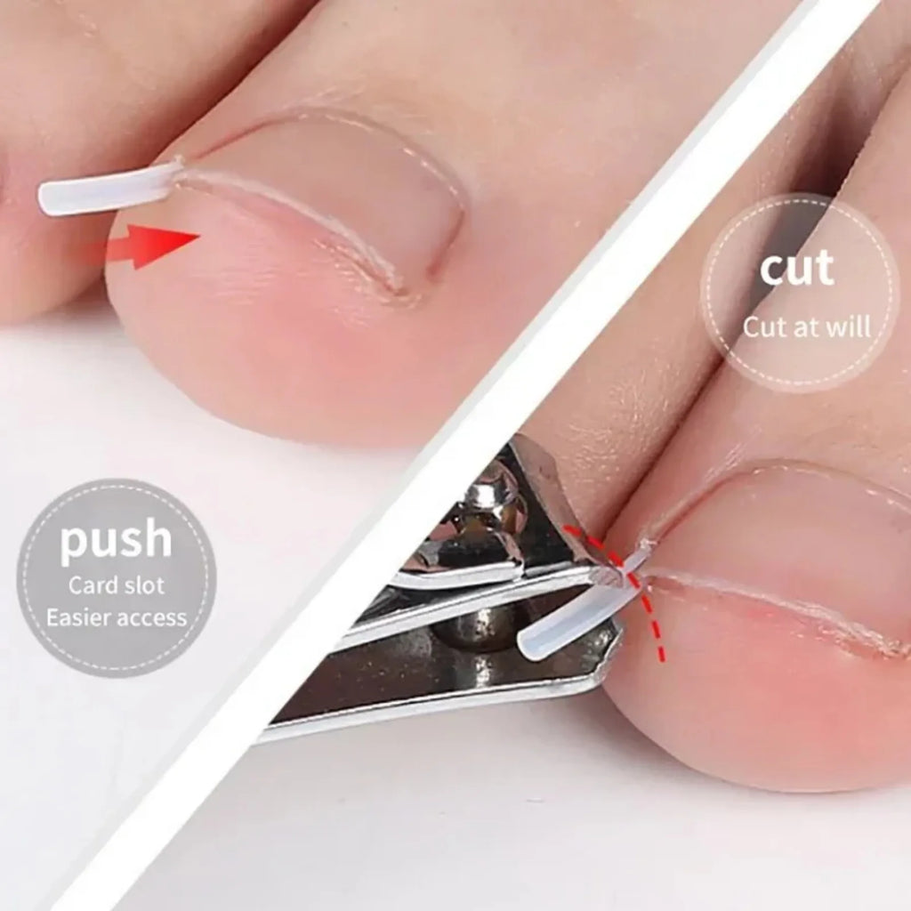 Kit de correction des ongles incarnés (50 pièces) : patch élastique, autocollant, clip redresseur et outil de pédicure