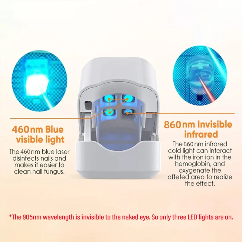 Traitement laser des mycoses des ongles, huile essentielle pour les ongles des orteils et des doigts, sérum pour soigner efficacement l'onychomycose des orteils