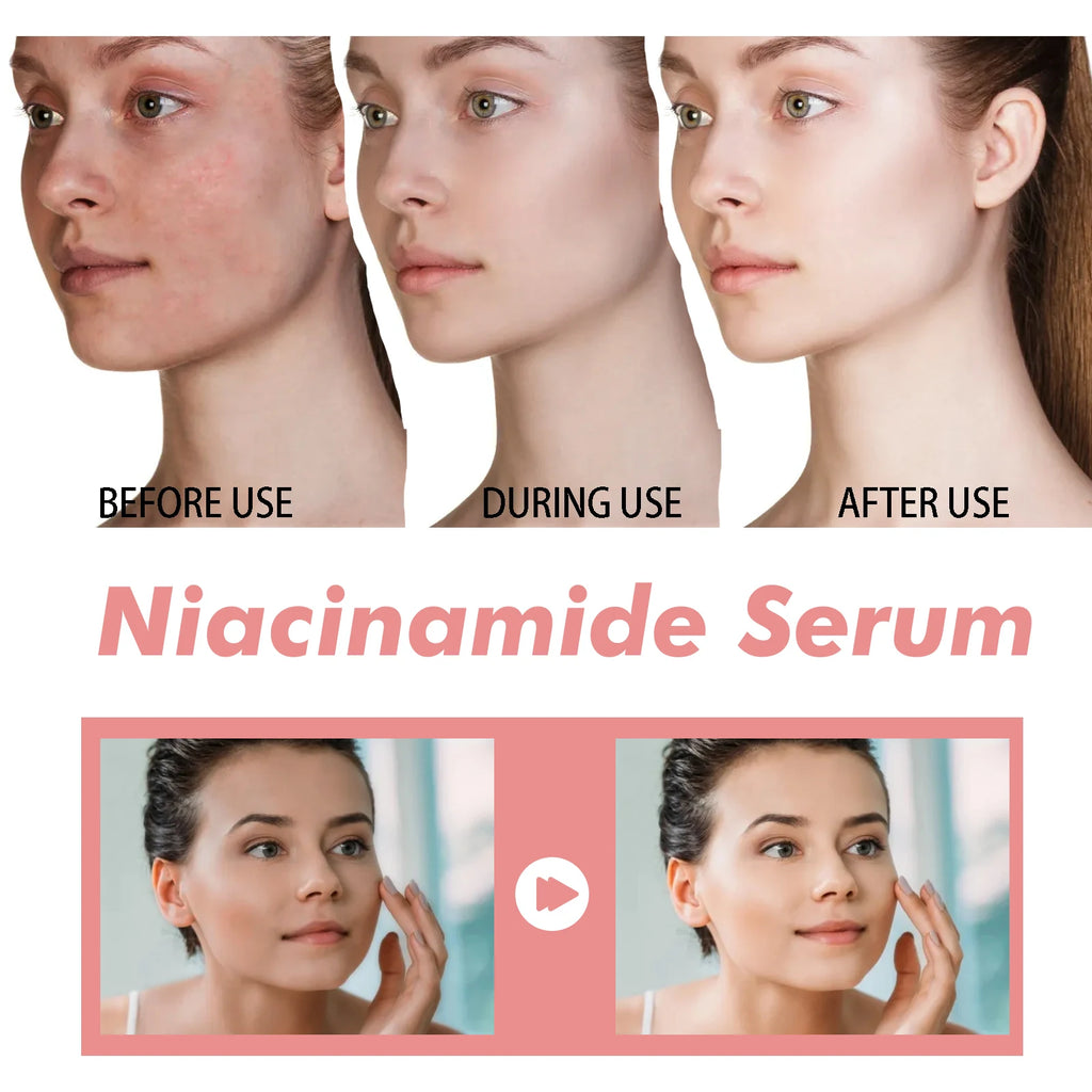 Sérum niacinamide 30ml éclaircissant les pores minimiseurs estompant les taches sombres hydratant uniformément le teint anti-âge du visage sérum non irritant