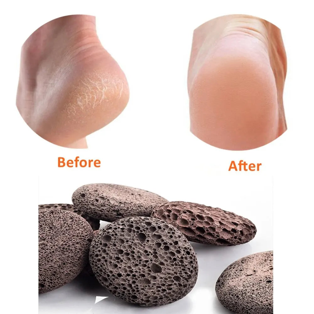 Pierre ponce, outil de pédicure à récurer, exfoliant naturel pour éliminer les callosités sur les mains, les talons et le corps