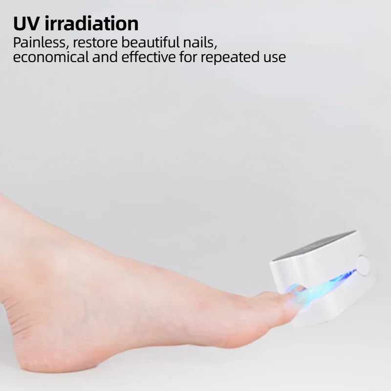 Traitement laser des mycoses des ongles, huile essentielle pour les ongles des orteils et des doigts, sérum pour soigner efficacement l'onychomycose des orteils