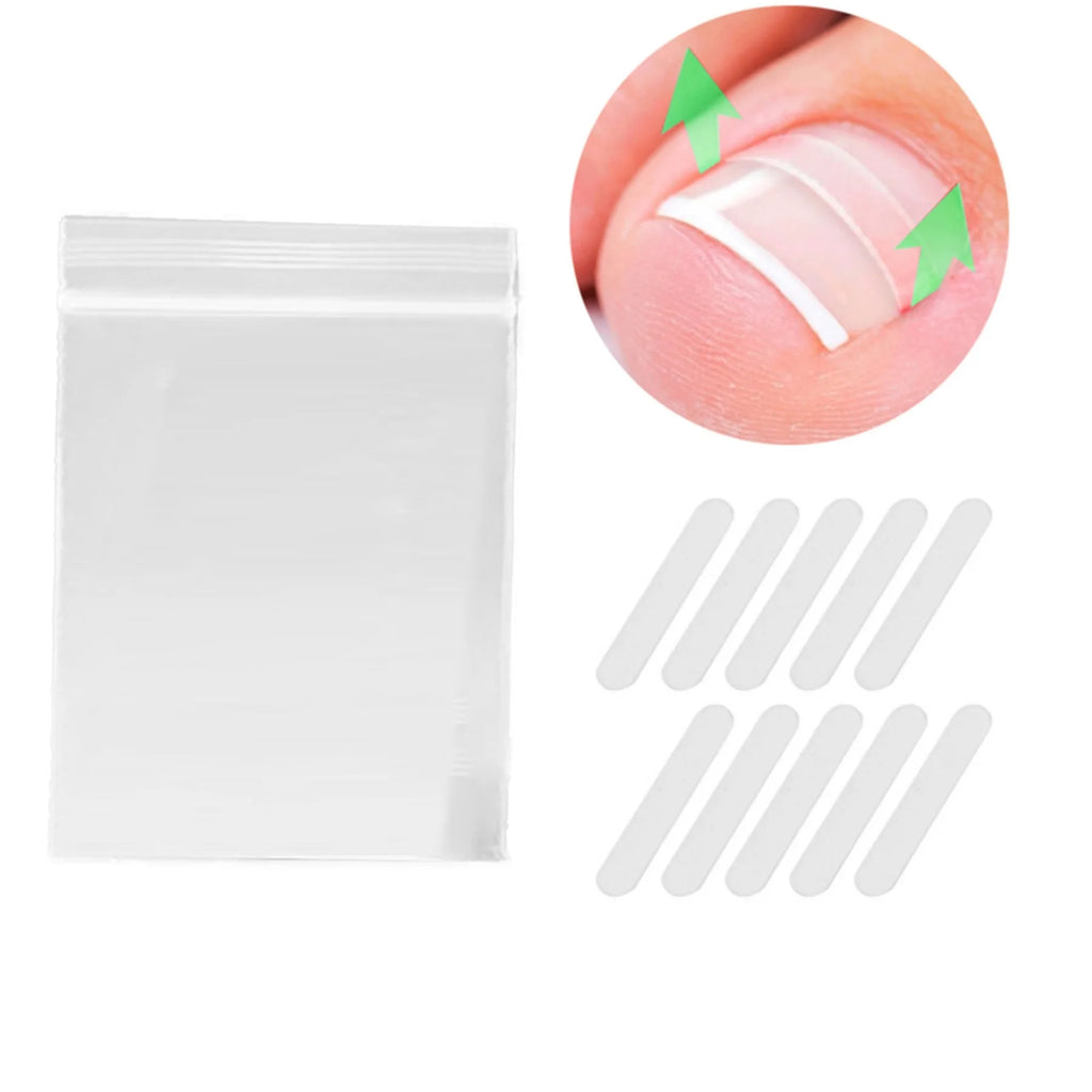Kit de correction des ongles incarnés (50 pièces) : patch élastique, autocollant, clip redresseur et outil de pédicure
