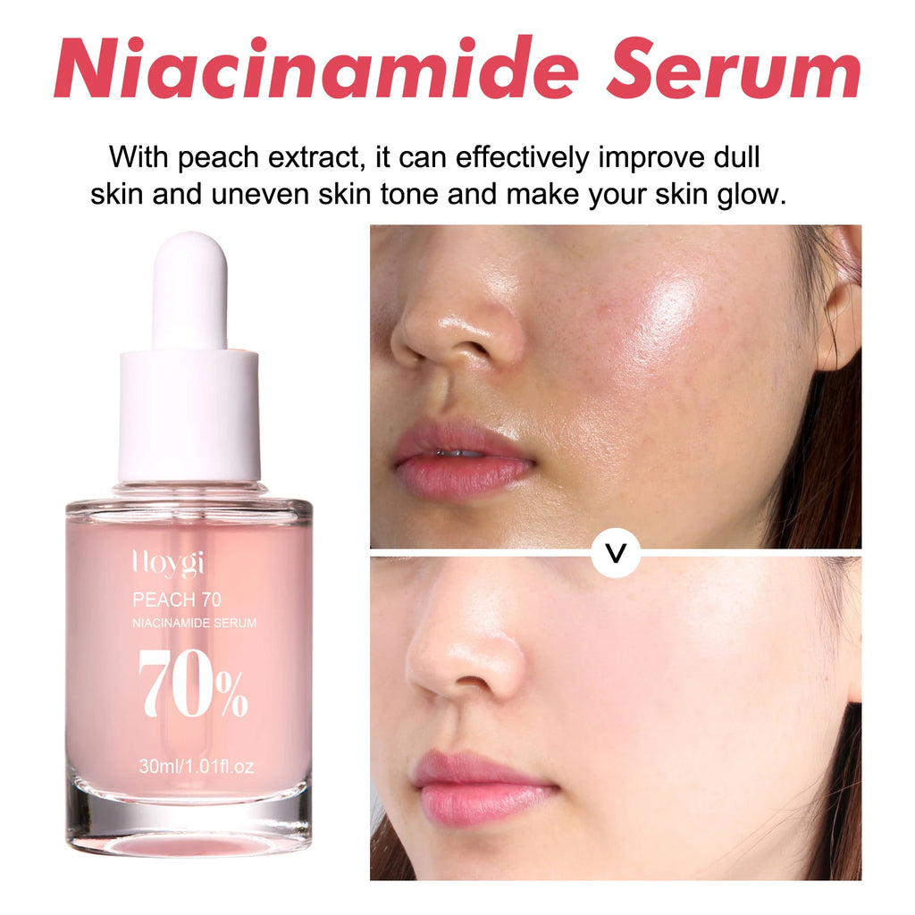 Sérum niacinamide 30ml éclaircissant les pores minimiseurs estompant les taches sombres hydratant uniformément le teint anti-âge du visage sérum non irritant
