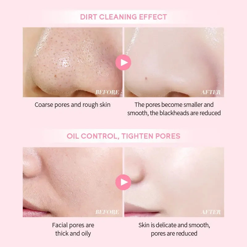 Laikou Sakura Masque de boue Nettoyant profond Contrôle des sébums Équilibre Antioxyde Rétrécissement des pores Enlève les points noirs Masque rafraîchissant du visage 90/25g